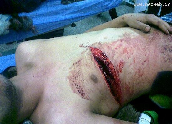 عاقبت نزاع و درگیری در قهوه خانه ای در تجریش (16+)