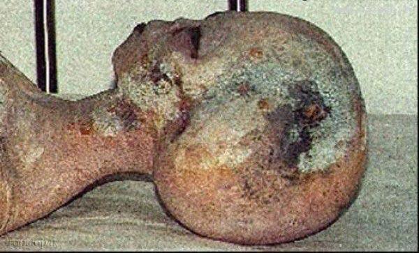 عکس های وحشتناک از بیگانگان مرده در جهان!! 16+