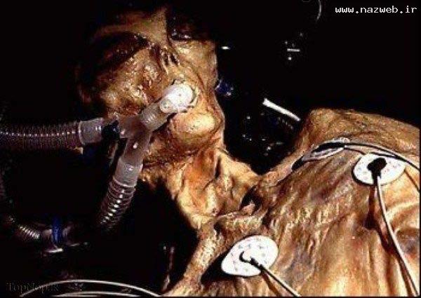 عکس های وحشتناک از بیگانگان مرده در جهان!! 16+