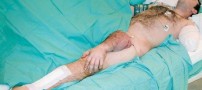 غیرقابل باورترین جراحی انجام شده در دنیا (عکس)