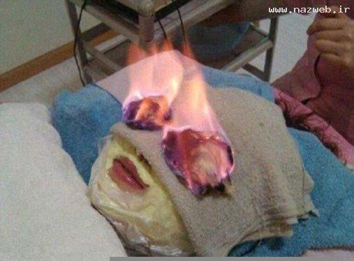 روش ترسناک و دیدنی زنان برای رفع چین و چروک