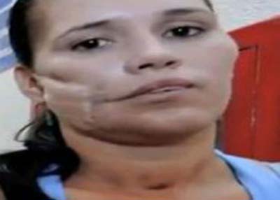 خروج نارنجک منفجر نشده از صورت این زن