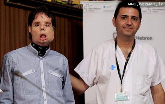  پیوند وحشتناک و باورنکردنی به صورت این مرد! عکس