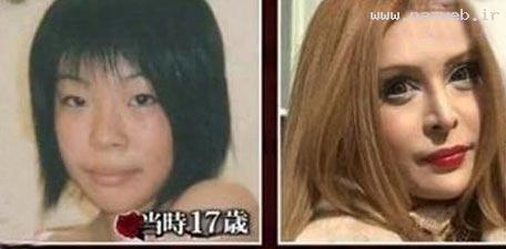 عکس دیدنی زن چینی قبل و بعد از عمل زیبایی
