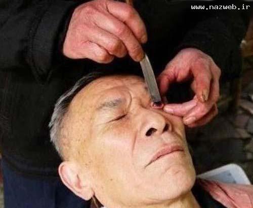 با دیدن این نوع ماساژ چشم شاخ در می آورید
