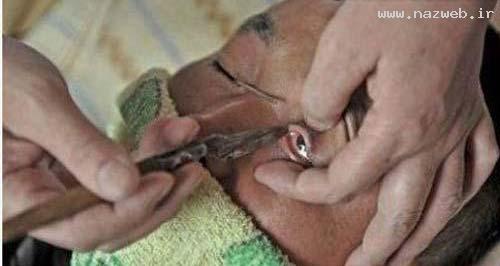 با دیدن این نوع ماساژ چشم شاخ در می آورید