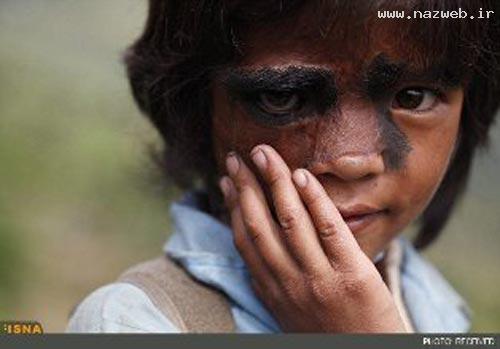 تصویری از انتخاب زشت ترین دختر نپالی