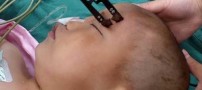 زنده ماندن بسیار عجیب و دیدنی پسر بچه ای دو ساله
