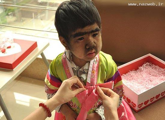 عکس های خفن دختری بارشد بی وقفه مو روی صورتش