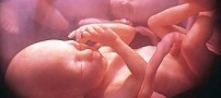 جزئیات سقط قانونی جنین