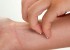 در حساسیت های پوستی چه بخوریم و چه نخوریم
