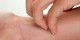 در حساسیت های پوستی چه بخوریم و چه نخوریم