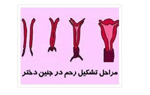 چگونگی تشخیص عارضه دو رحمی