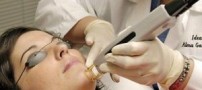 لیزر کردن موهای زاید همراه با تصویر و پرسش و پاسخ