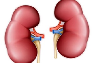 سنگ اداری یا کلیه چه علائمی دارد