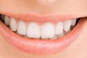 دشمنان سفیدی دندان ها چیست