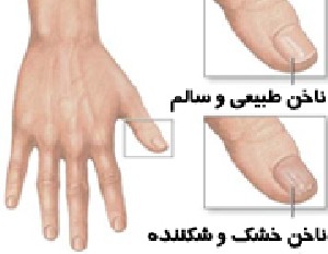 هر مشکلی روی ناخن ها نشانه چیست هر مشکلی روی ناخن ها نشانه چیست