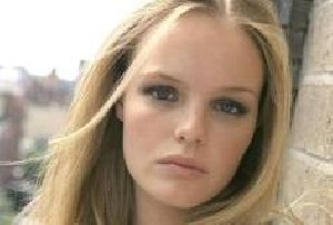راه های معالجه ملاسما یا لک صورت