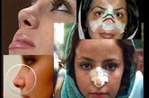 آماری تکان دهنده از هزینه ایرانیها برای دماغ!