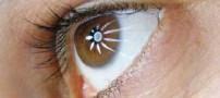 نکات مهم در مورد نزدیک بینی