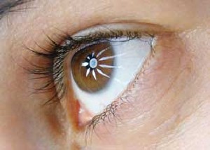 نکات مهم در مورد نزدیک بینی نکات مهم در مورد نزدیک بینی