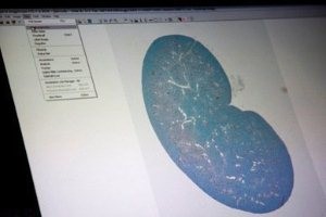 جدیدترین اخبار پزشکی در ساخت کلیه مصنوعی