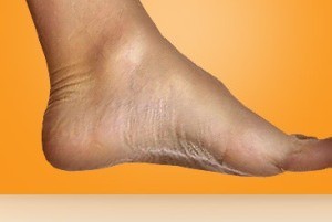راه کار بسیار ساده برای زق زق کردن و درد کف پا