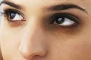 دلایل سیاهی دور چشم چیست