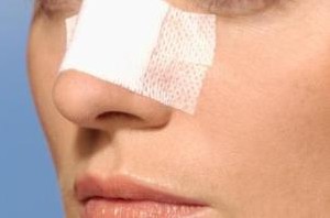 تمام آنچه باید در مورد جراحی بینی بدانید