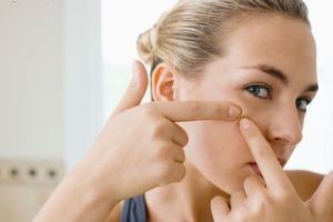 چاره ی جای جوش ها چیست چاره ی جای جوش ها چیست