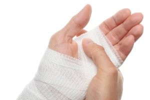 رعایت نکاتی برای سوختگی رعایت نکاتی برای سوختگی
