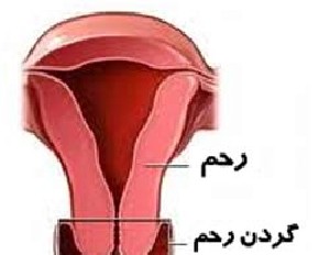 زخم دهانه رحم در خانمها چه علائمی دارد زخم دهانه رحم در خانمها چه علائمی دارد