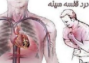 نشانه های سکته چیست نشانه های سکته چیست