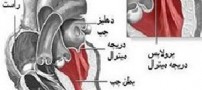 علایم بیماری افتادگی دریچه میترال