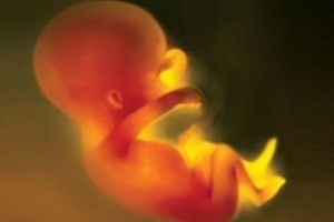 شنیدن صدای قلب جنین با خالکوبی!