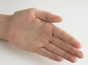 علت خارش کف دست چیست؟!