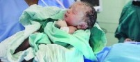 تصویری از تولد کم وزن ترین نوزاد ایران