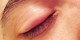 گل مژه و قند خون چه ارتباطی با هم دارند