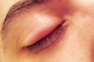 گل مژه و قند خون چه ارتباطی با هم دارند